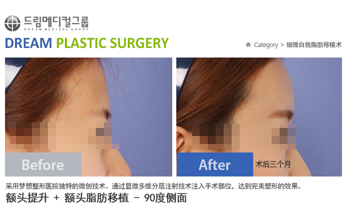 관련이미지