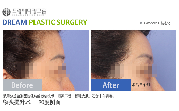 관련이미지