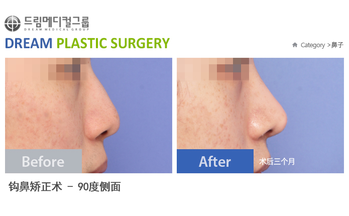 관련이미지
