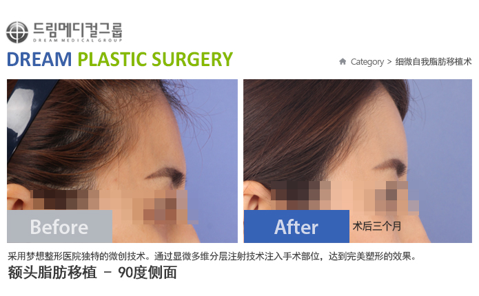 관련이미지