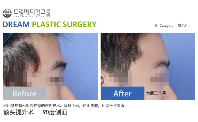 관련이미지