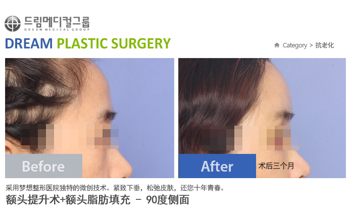 관련이미지
