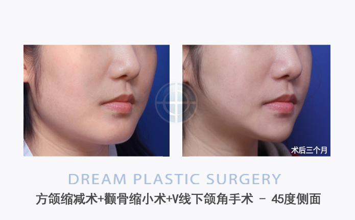 관련이미지