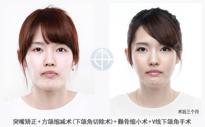 관련이미지