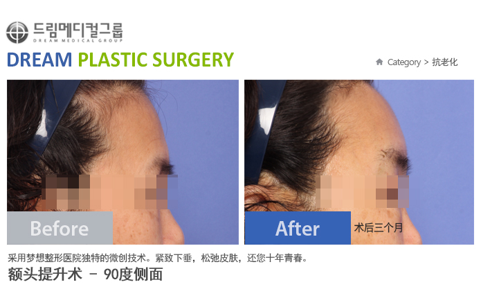 관련이미지