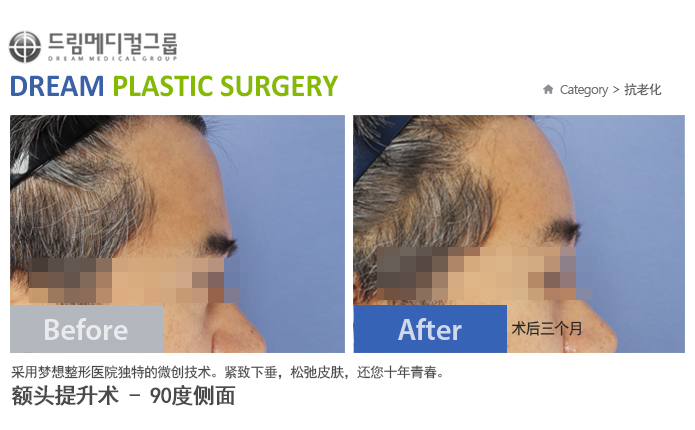 관련이미지