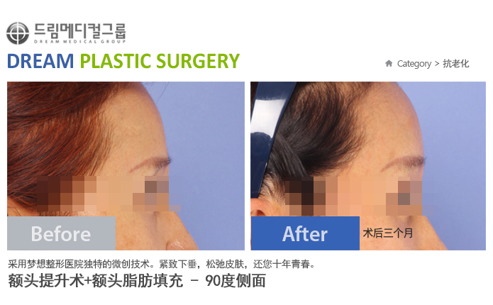 관련이미지