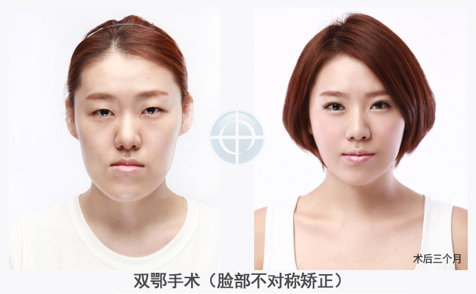 관련이미지