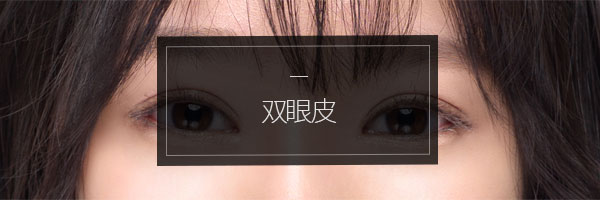 쌍꺼풀