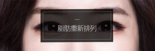 지방배치