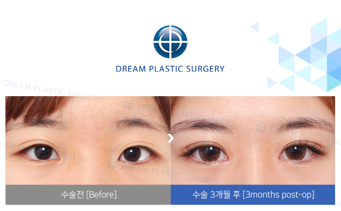 관련이미지