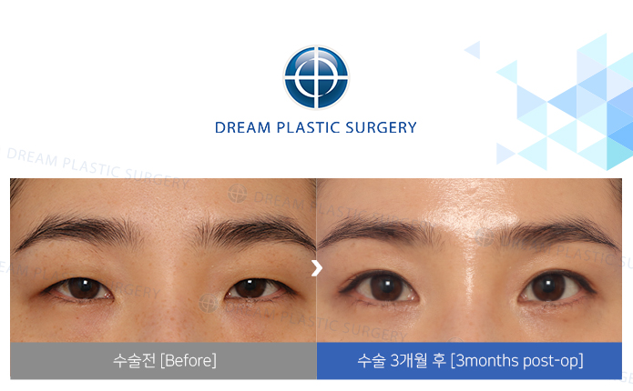 관련이미지