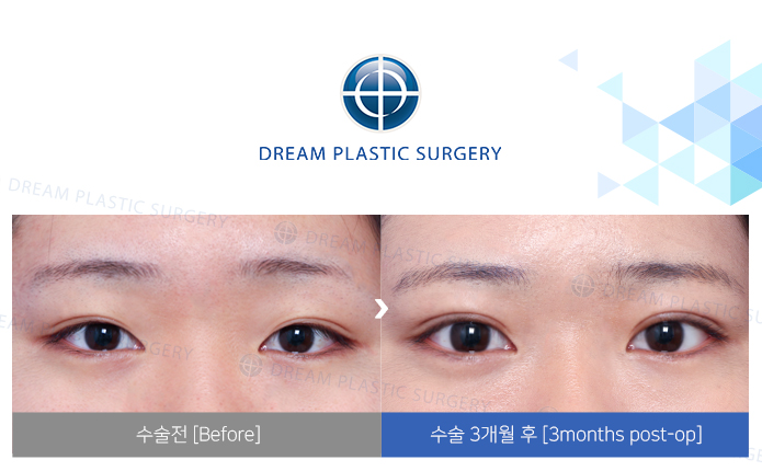 관련이미지