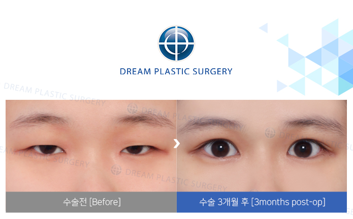 관련이미지