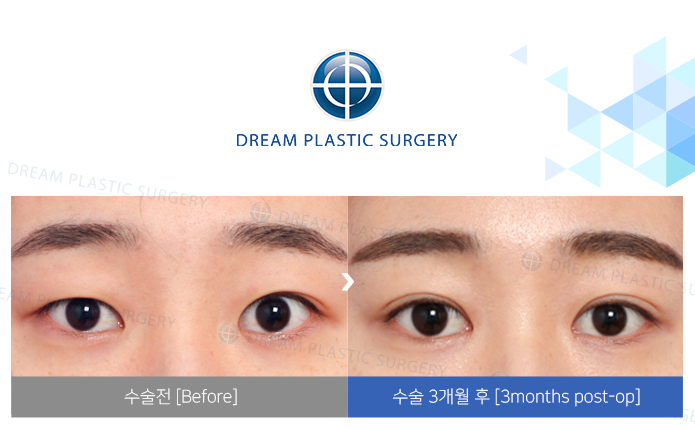 관련이미지