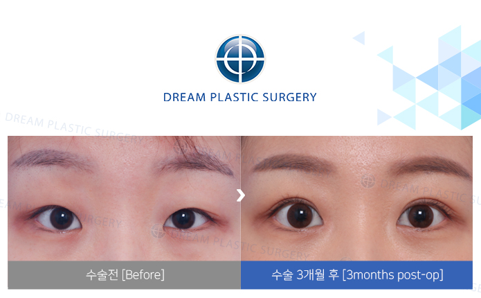 관련이미지