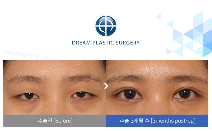 관련이미지