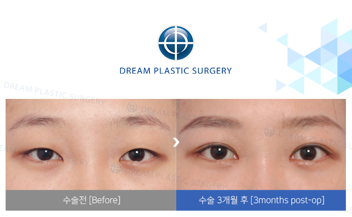 관련이미지