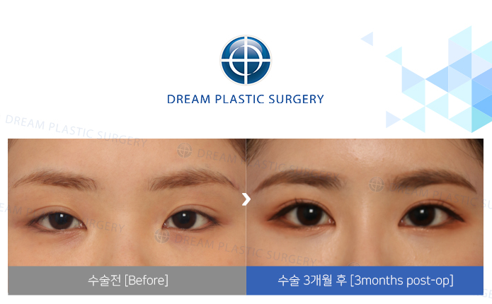 관련이미지