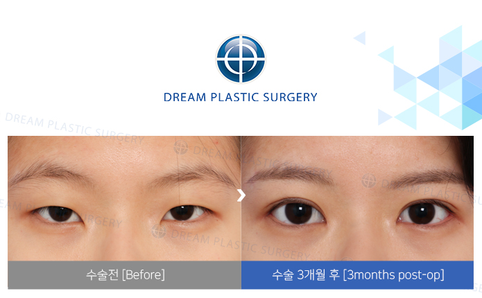 관련이미지