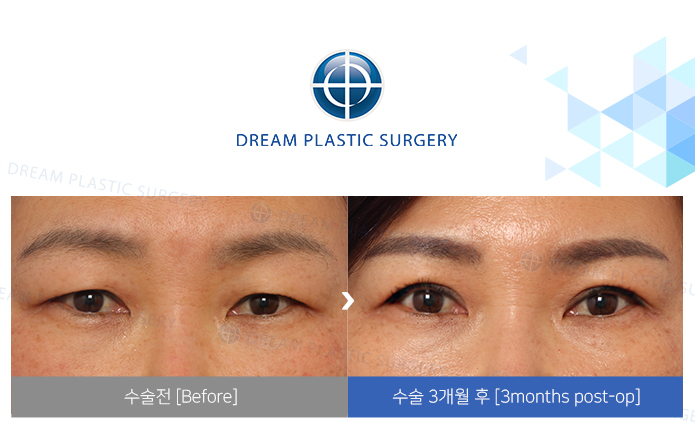 관련이미지