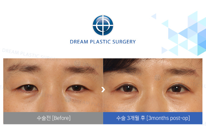 관련이미지