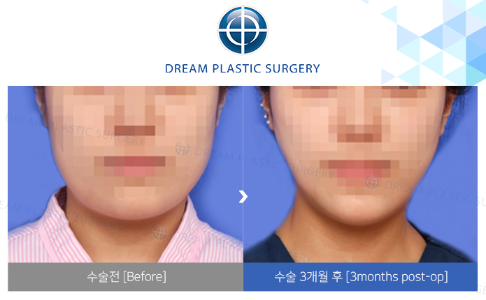 관련이미지