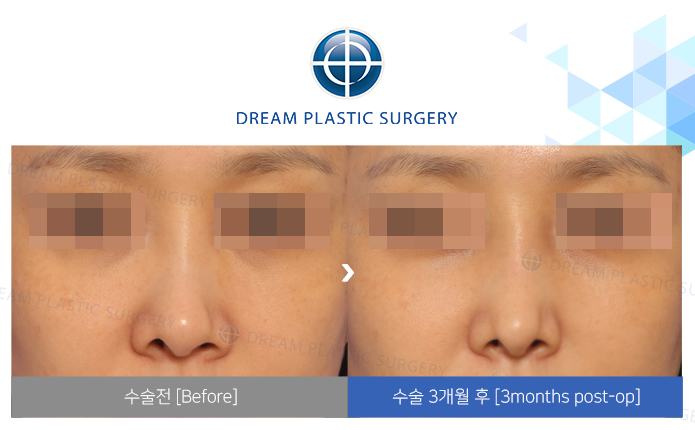 관련이미지