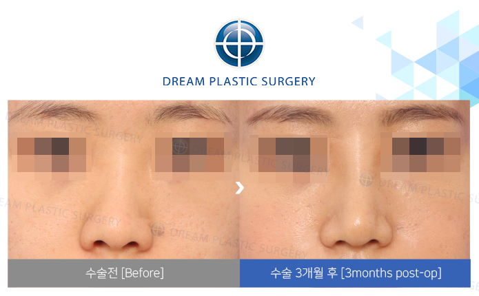 관련이미지