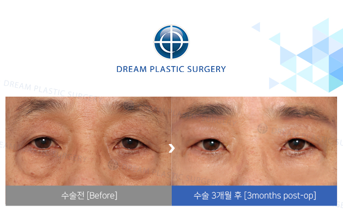 관련이미지
