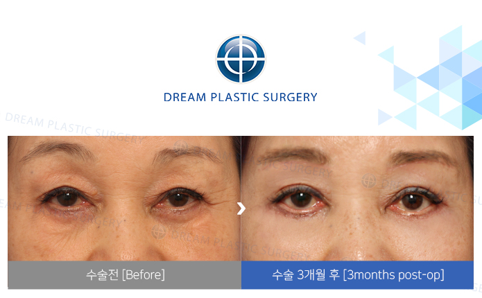 관련이미지