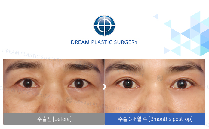 관련이미지