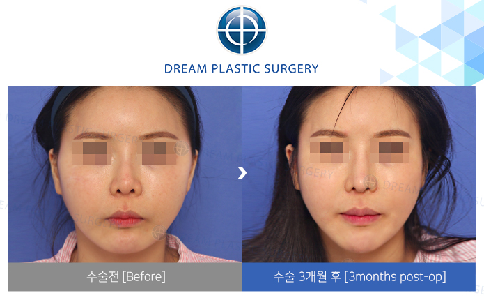 관련이미지