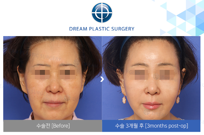 관련이미지