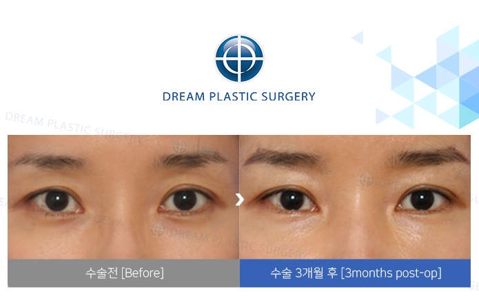 관련이미지